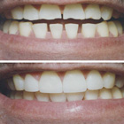 Cosmetic Dentistry