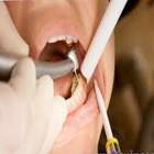 Endodontic Treatment